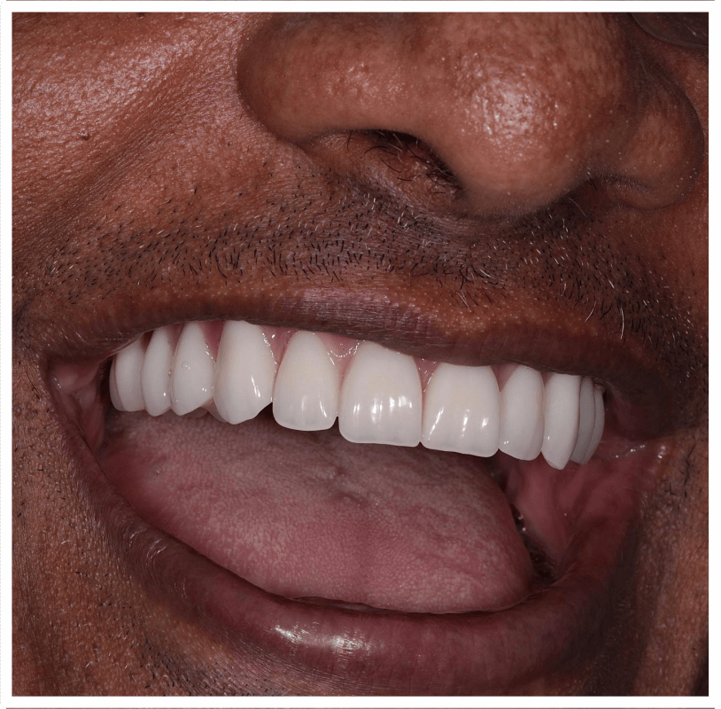 dentista em brusque